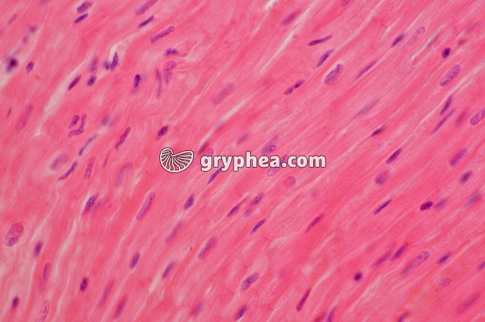 Mucle cardiaque CL x160 - gryphea.com